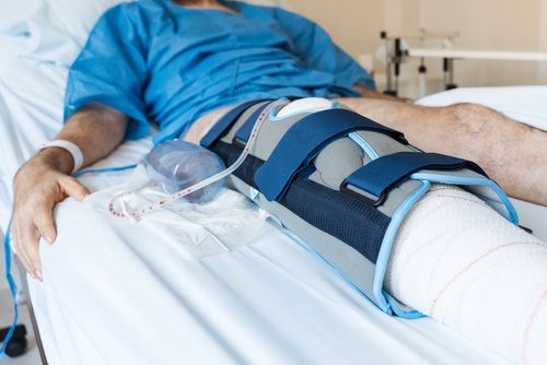 $315,000.00 Settlement - Workers' Compensation Case